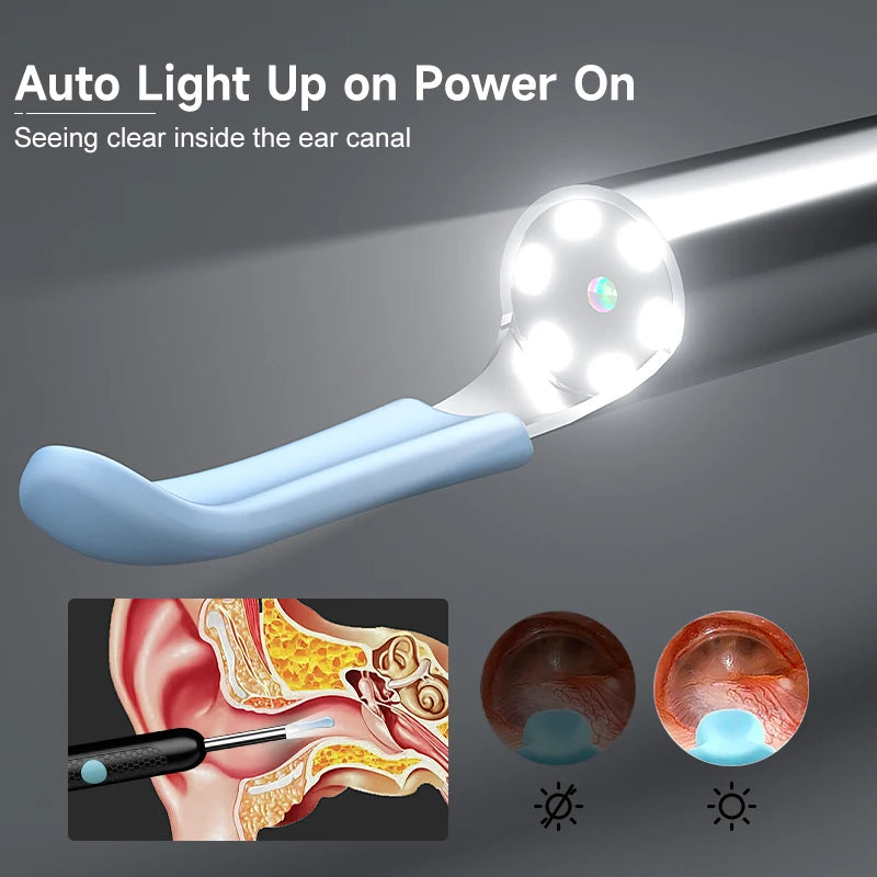 Smart Ear Cleaner