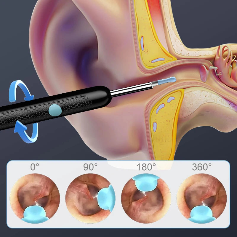 Smart Ear Cleaner