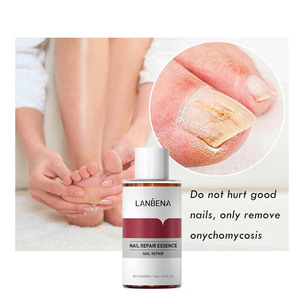 Nail Nourish & Repair Essence